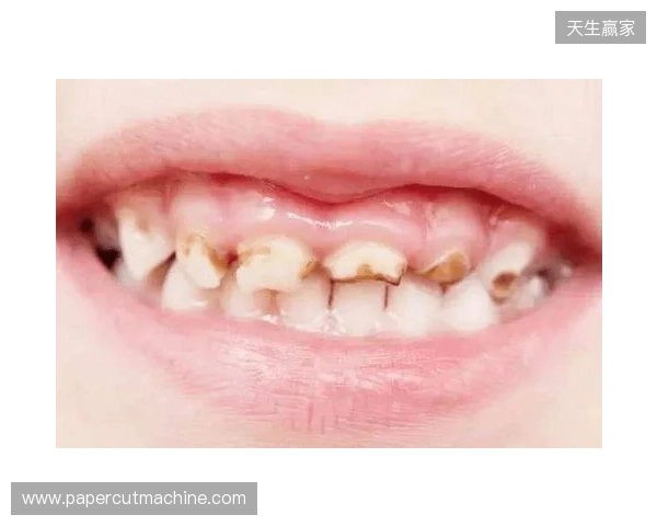 韦林顿确诊上唇部贯通伤；11、21牙半脱位；上颌前牙区牙槽骨骨折