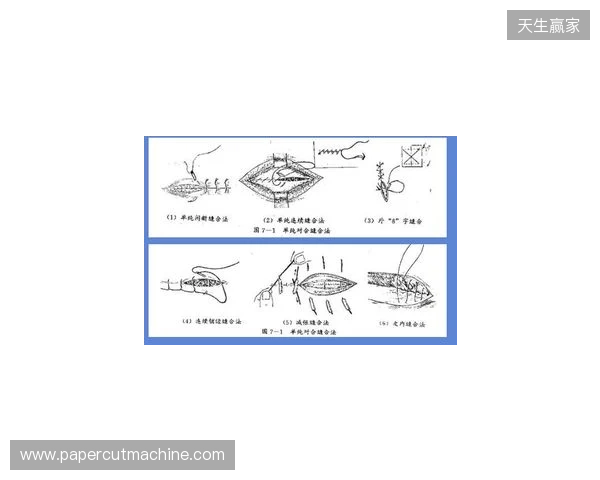 广州豹官方：杨浩眉弓伤口缝合30余针，预计5-7天后拆线